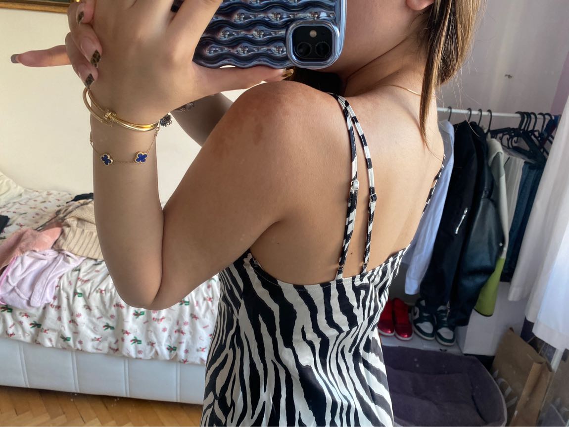 Bershka elbise — görsel 4/8